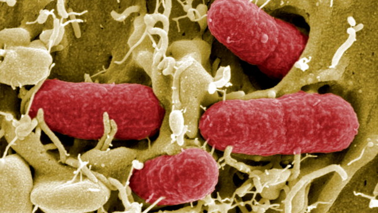 EHEC-Bakterien; Bild: dpa