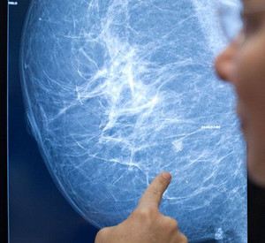 Vorsorgeuntersuchungen sind wichtig, um Krebs frühzeitig zu erkennen; Bild: dpa