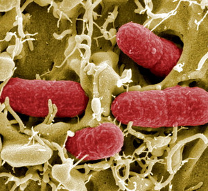 EHEC-Bakterien; Bild: dpa